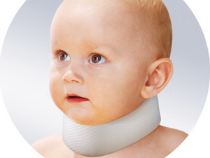 Кривошея у ребенка